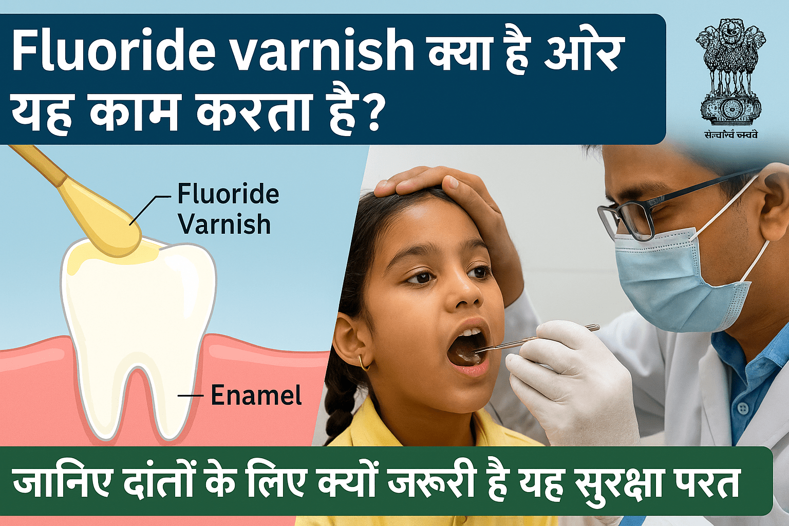 Illustration showing dentist applying fluoride varnish on a patient’s teeth, highlighting cavity protection and dental health benefits.