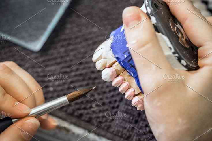 Dental crown preparation process illustration Crown, Bridge, Denture