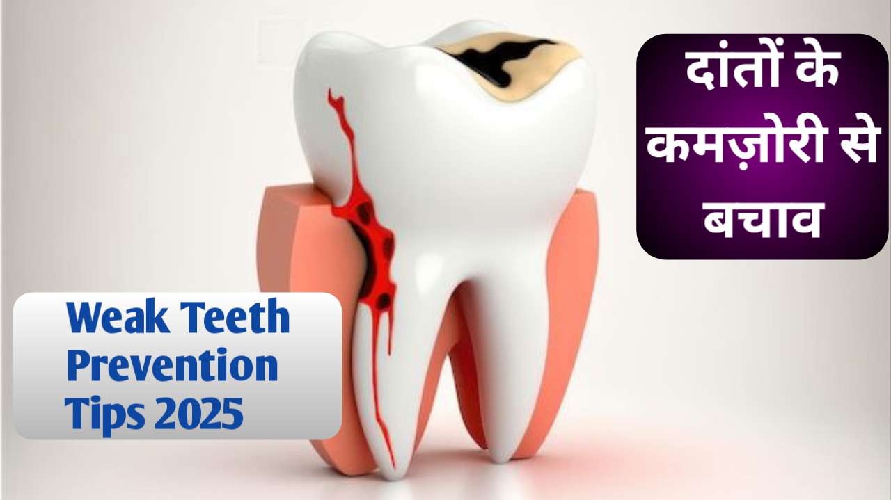 दांतों की कमजोरी से बचाव | Weak Teeth Prevention Tips